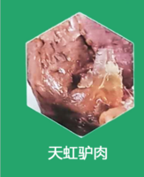 天虹驴肉